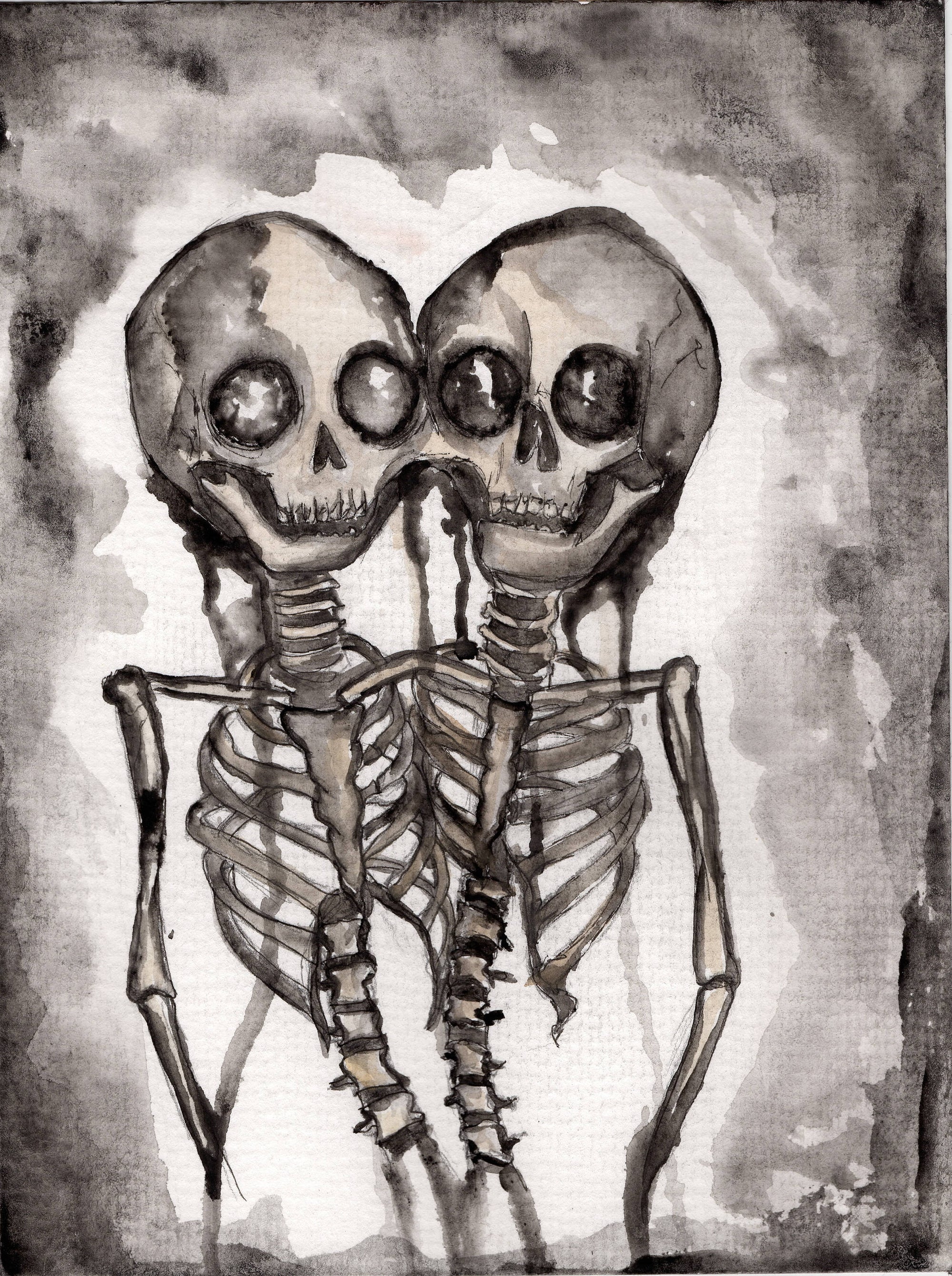 Conjoined Twin Skeleton Dark Art Print